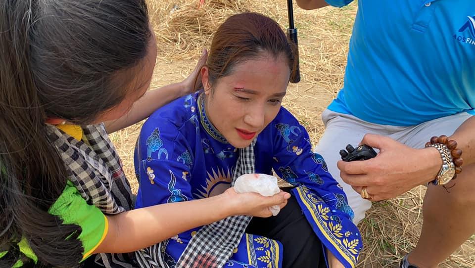 MC Cát Tường tai nạn, phải khâu sống 3 mũi trên mặt ngay tại trường quay-3