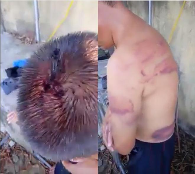 Người đàn ông mù đi ăn xin ở Nghệ An nghi bị vợ hờ đánh đập, bầm tím khắp người-2