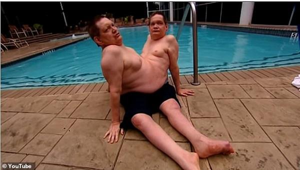 Cặp song sinh liền thân lớn tuổi nhất thế giới đã qua đời-6