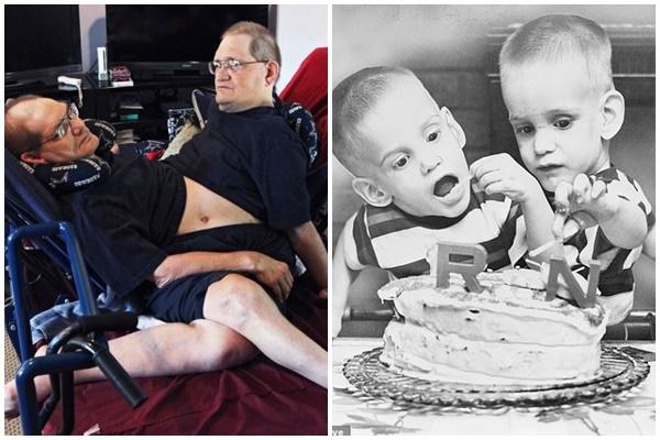 Ca mổ tách dính phức tạp cho 2 bé 13 tháng tuổi: Kéo dài 12 tiếng, êkip mổ 90 người-3