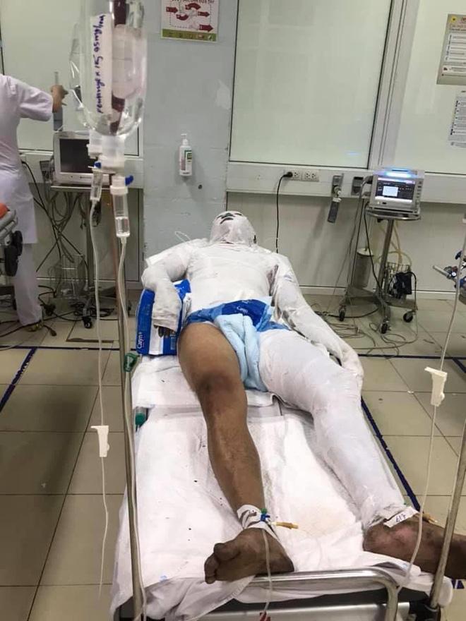 Vụ nam thanh niên bị chặn đường đổ xăng đốt: Món nợ 2,5 triệu đồng và mâu thuẫn đồng nghiệp cũ?-2