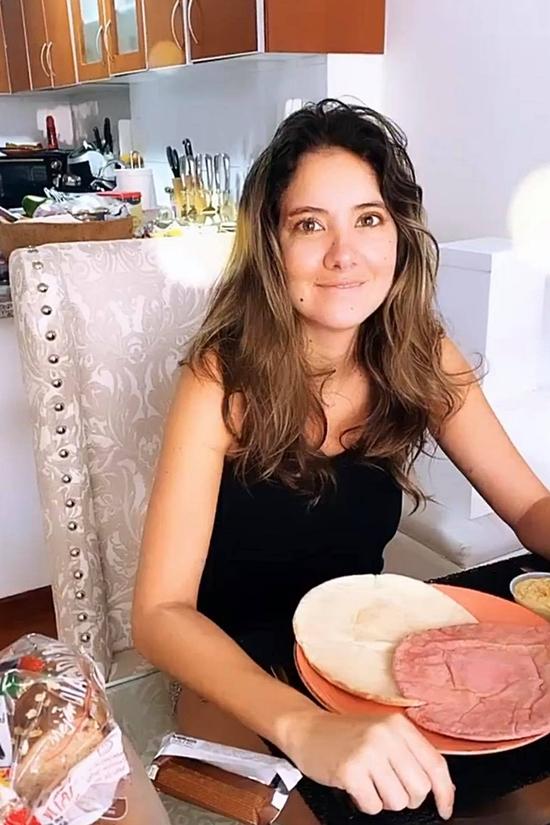 Hoa hậu Colombia làm quen cuộc sống mới sau cưa chân-6