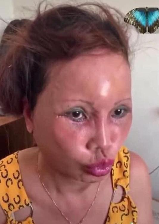 Cô dâu Cao Bằng nhập viện sau tuyên bố chết cũng phải làm con ma đẹp-4