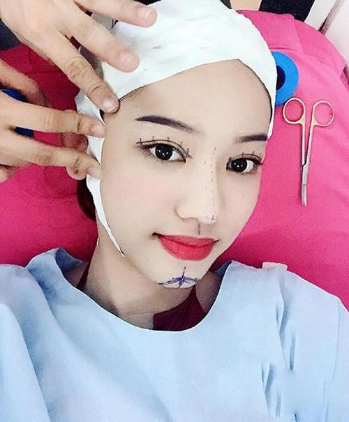 Thúy Vi dao kéo lần thứ n, dân tình soi thẩm mỹ hỏng rồi-9