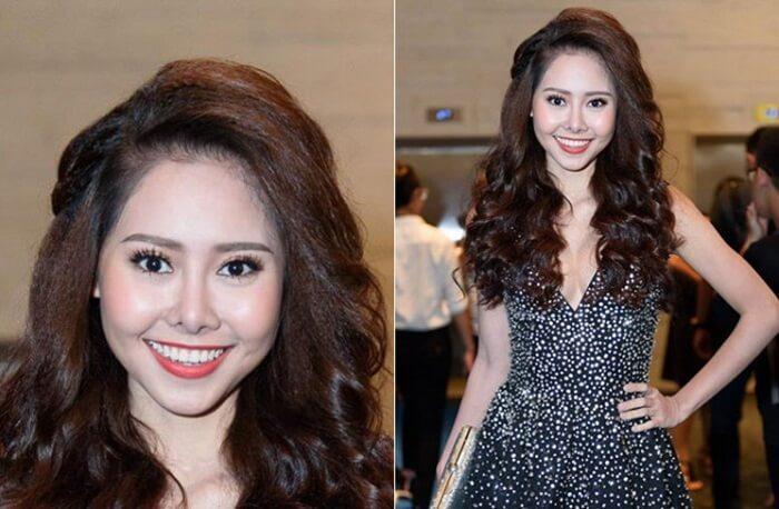 Biến chứng hậu phẫu thuật nâng mũi, cô gái bị áp xe đến lòi cả sụn-4