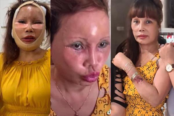 Cô dâu 63 tuổi ở Cao Bằng tố ông xã đong đưa gái trẻ, dấu hiệu rạn nứt hôn nhân-7