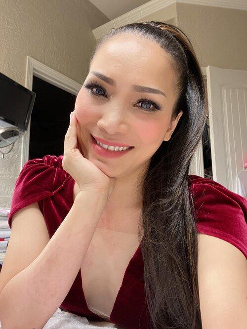 Hồng Ngọc khoe cận nhan sắc rạng rỡ sau bỏng nặng, lộ ra một số thương tích khó lành-3