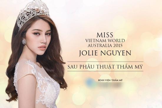 Jolie Nguyễn thú nhận từng phẫu thuật thẩm mỹ