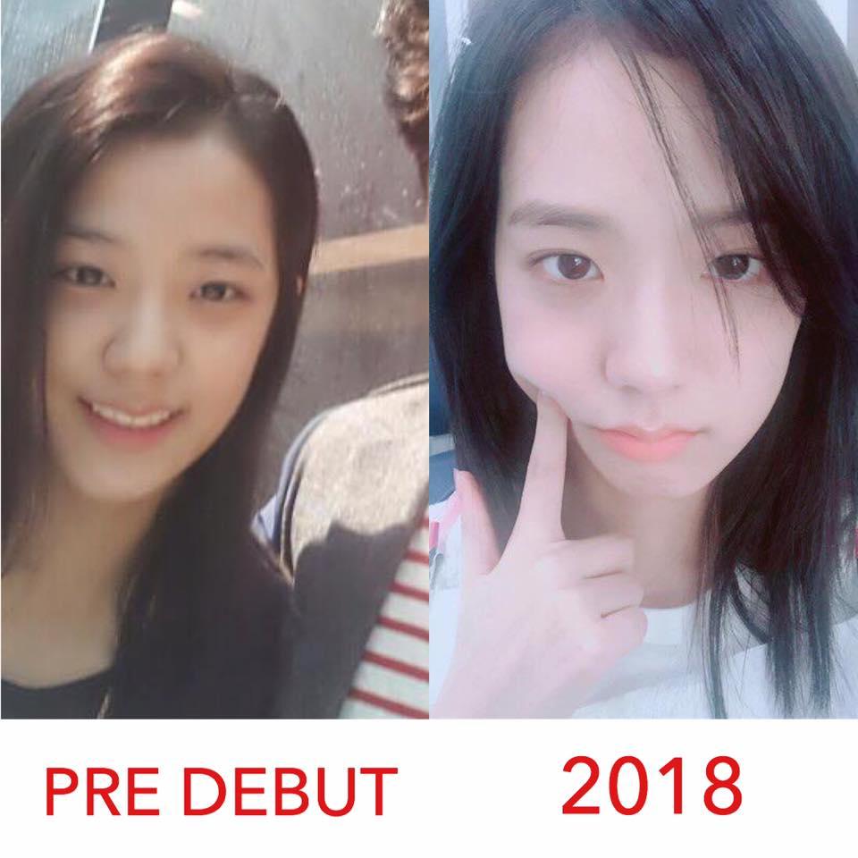 Mặt mộc của 4 nữ thần BLACKPINK: Mỗi người một vẻ mười phân vẹn mười-10