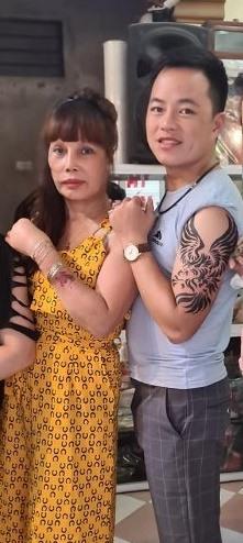 3 tuần sau dao kéo, cô dâu 63 tuổi ở Cao Bằng miệng méo đáng thất vọng-3