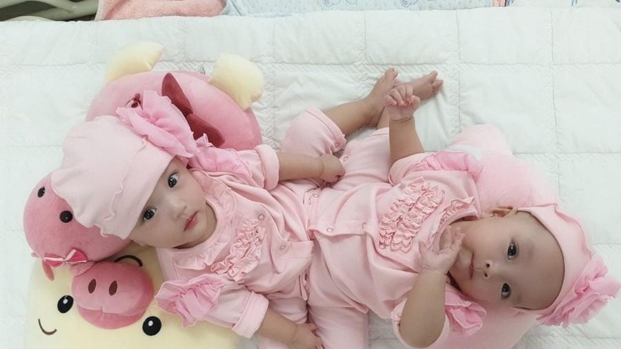 Ca mổ tách dính phức tạp cho 2 bé 13 tháng tuổi: Kéo dài 12 tiếng, êkip mổ 90 người-2