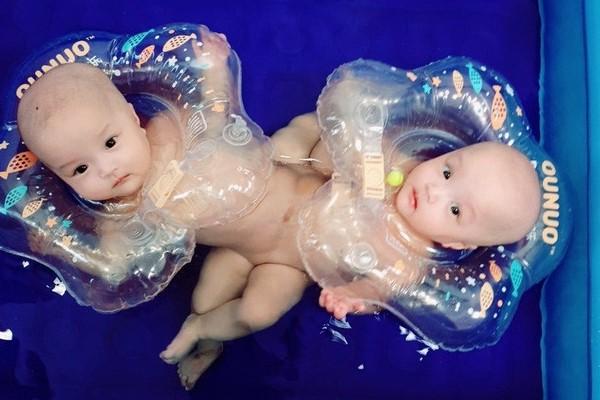 Bắt đầu ca đại phẫu cân não kéo dài 12 giờ tách rời cặp song sinh phức tạp nhất Việt Nam-9