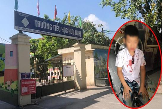 Vợ kẻ hành hung bé trai lớp 1: 'Chồng tôi chỉ tát cháu sưng mồm thôi...'