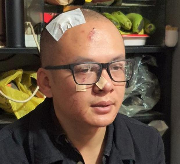 Khu du lịch Quỷ Núi sẽ loại bỏ những hạng mục phản cảm sau khi bị phản ứng-2