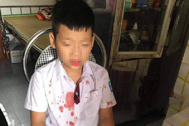 Hà Nội: Mâu thuẫn vì con quẹt thẻ thừa 6 lượt bơi, người bố tự xưng công an hùng hổ đánh mạnh vào đầu nữ nhân viên-2