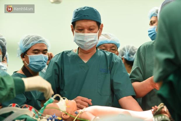 Cập nhật: Hình ảnh từ phòng đại phẫu sinh tử, tách 2 bé dính nhau khó nhất Việt Nam-9