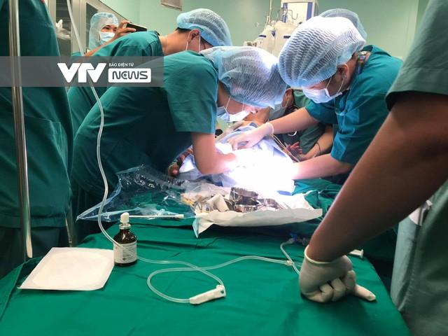 Cập nhật: Hình ảnh từ phòng đại phẫu sinh tử, tách 2 bé dính nhau khó nhất Việt Nam-13