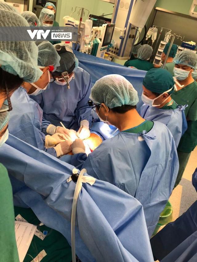 Cập nhật: Hình ảnh từ phòng đại phẫu sinh tử, tách 2 bé dính nhau khó nhất Việt Nam-12