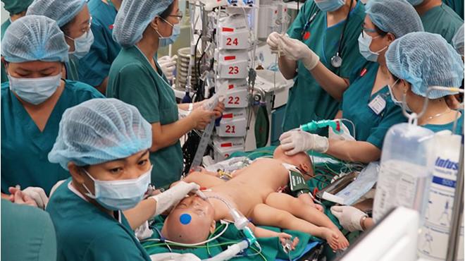 Full hình ảnh từ phút sinh ra đến ca đại phẫu sinh tử của 2 bé song sinh dính liền cơ thể-17