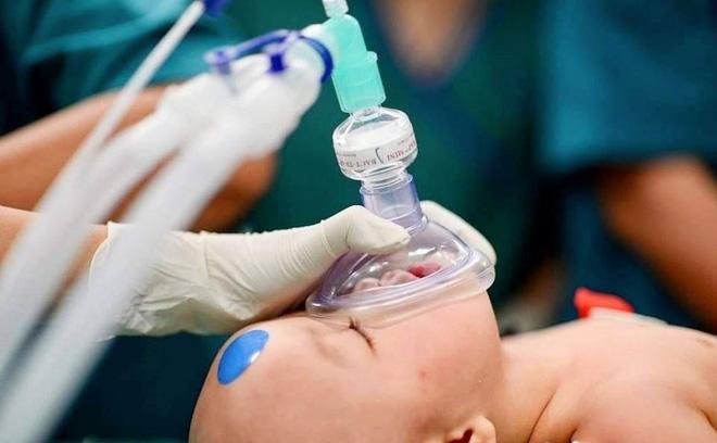 Full hình ảnh từ phút sinh ra đến ca đại phẫu sinh tử của 2 bé song sinh dính liền cơ thể-14