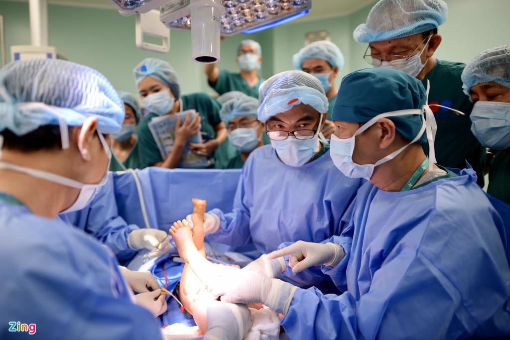 8 tiếng phẫu thuật liên tục, cặp song sinh dính liền được tách rời thành công-10