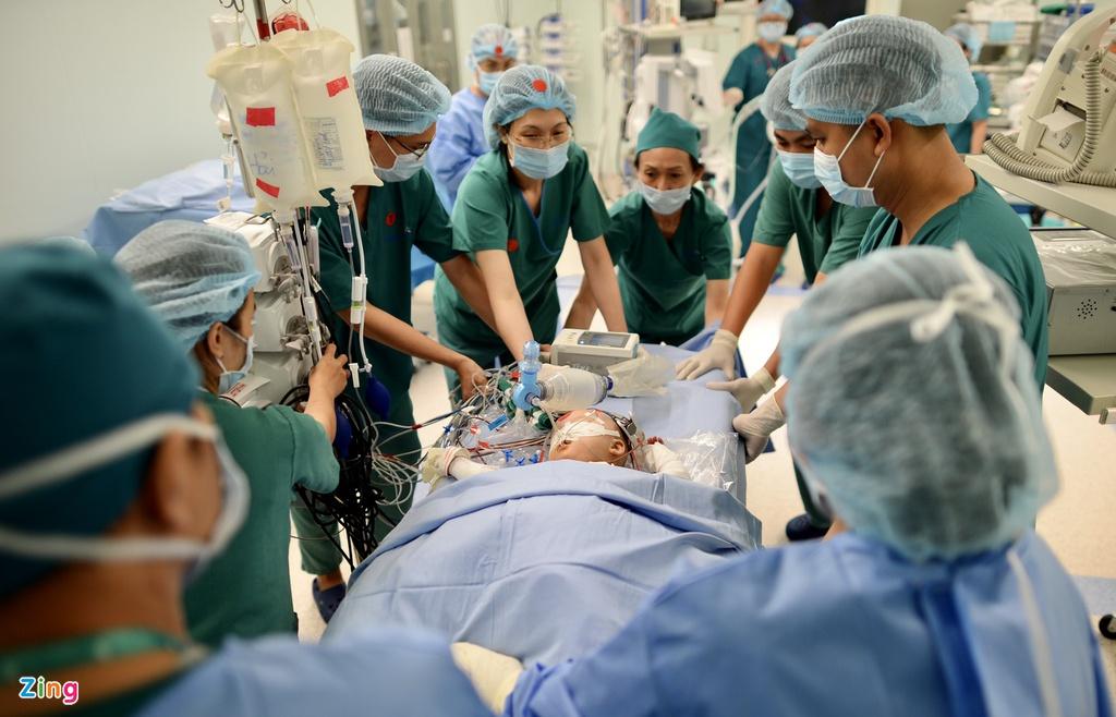 8 tiếng phẫu thuật liên tục, cặp song sinh dính liền được tách rời thành công-13