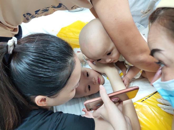 Full hình ảnh từ phút sinh ra đến ca đại phẫu sinh tử của 2 bé song sinh dính liền cơ thể-10