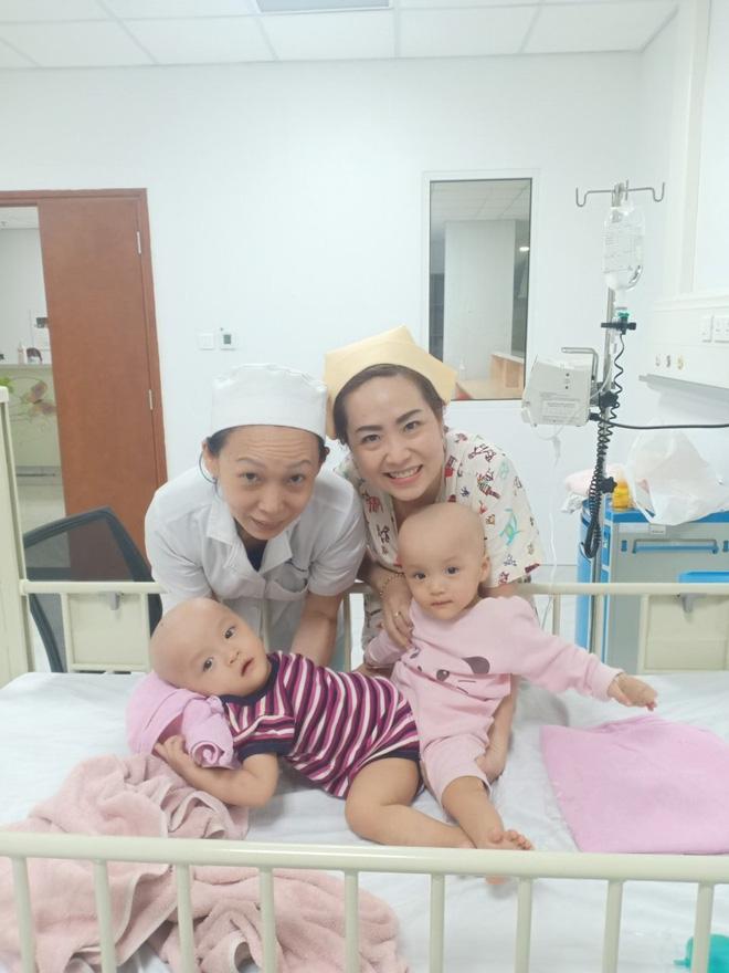 Full hình ảnh từ phút sinh ra đến ca đại phẫu sinh tử của 2 bé song sinh dính liền cơ thể-9