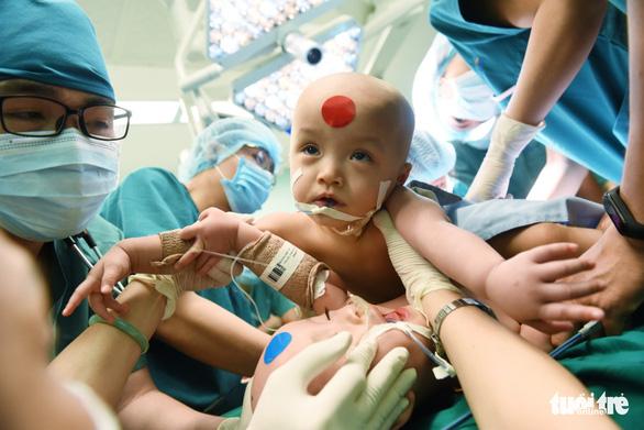 Full hình ảnh từ phút sinh ra đến ca đại phẫu sinh tử của 2 bé song sinh dính liền cơ thể-16