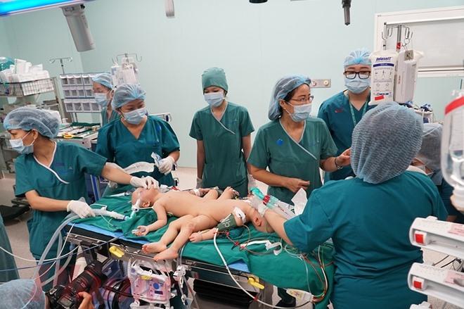 Sao Việt nín thở - vỡ òa khi 2 bé gái song sinh thực hiện ca mổ tách thành công-1