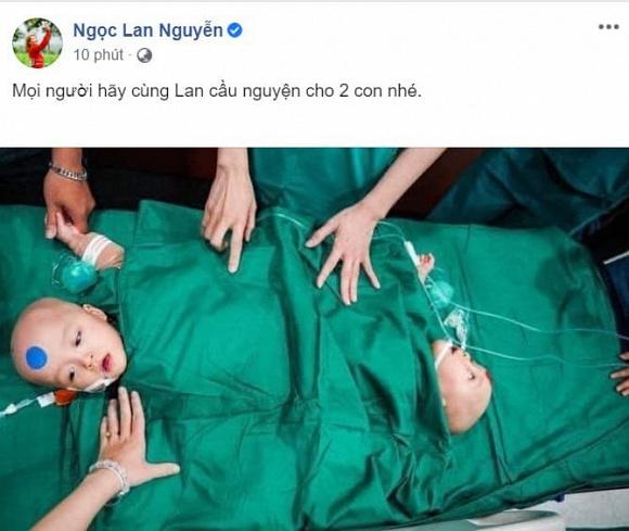 Sao Việt nín thở - vỡ òa khi 2 bé gái song sinh thực hiện ca mổ tách thành công-10