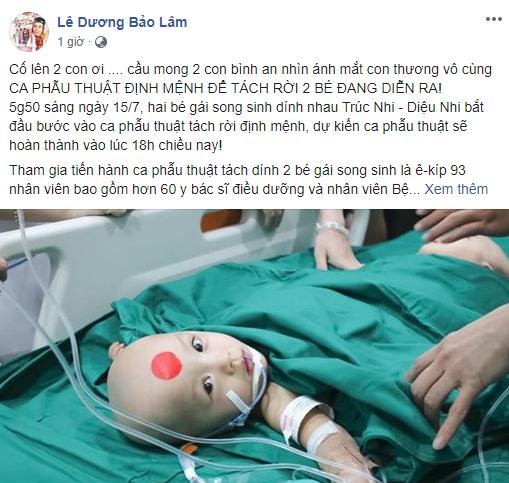 Sao Việt nín thở - vỡ òa khi 2 bé gái song sinh thực hiện ca mổ tách thành công-11