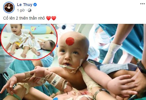 Sao Việt nín thở - vỡ òa khi 2 bé gái song sinh thực hiện ca mổ tách thành công-12