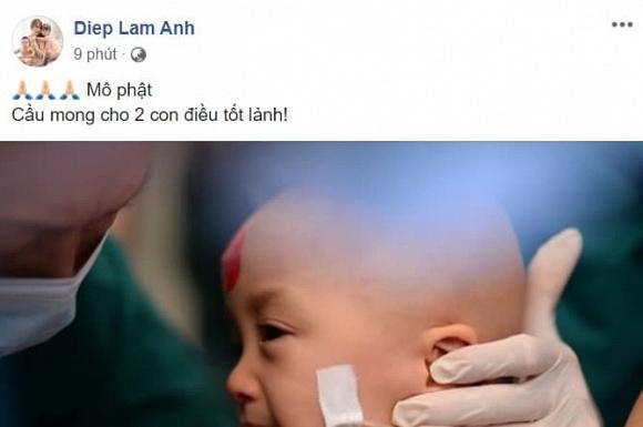 Sao Việt nín thở - vỡ òa khi 2 bé gái song sinh thực hiện ca mổ tách thành công-4