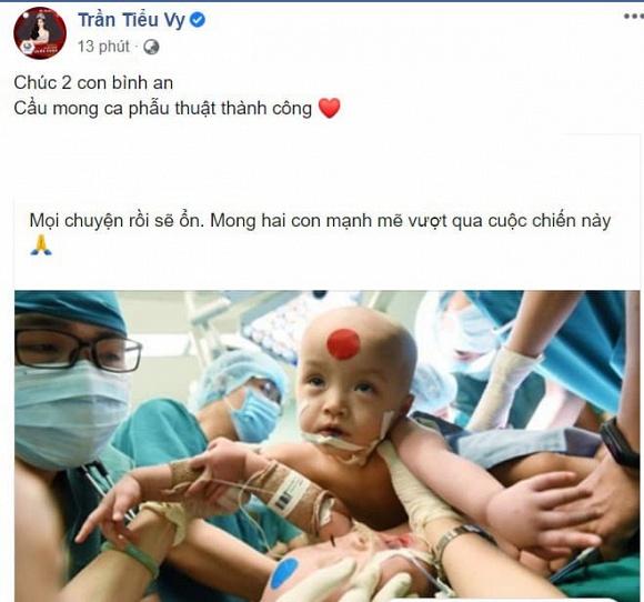 Sao Việt nín thở - vỡ òa khi 2 bé gái song sinh thực hiện ca mổ tách thành công-9