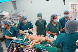 Sao Việt nín thở - vỡ òa khi 2 bé gái song sinh thực hiện ca mổ tách thành công