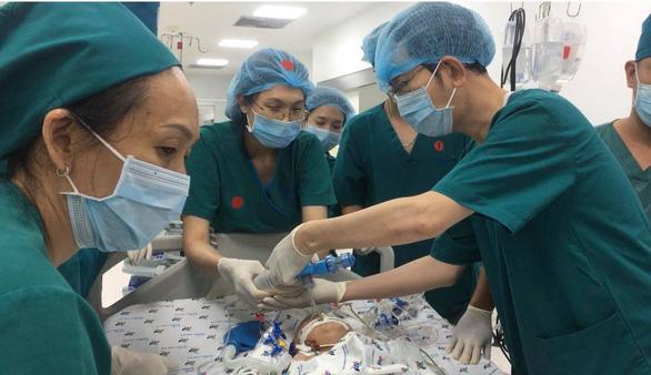Full hình ảnh từ phút sinh ra đến ca đại phẫu sinh tử của 2 bé song sinh dính liền cơ thể-23