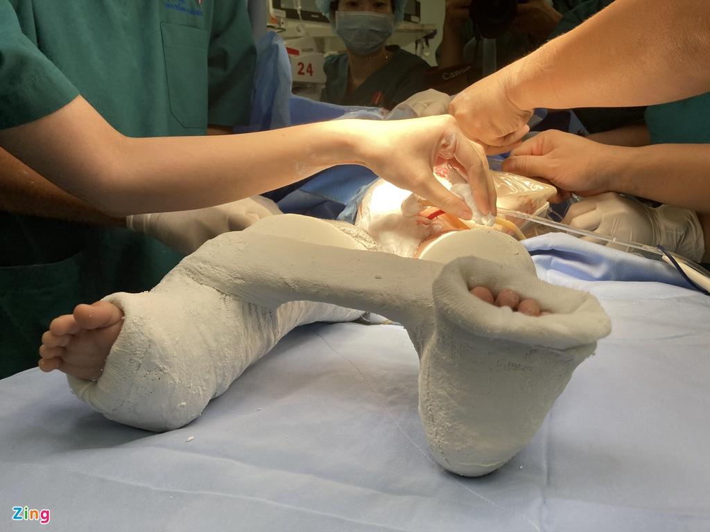 Đã tách rời xong cặp Song Nhi, hoàn thiện khâu tạo hình cho cả 2 bé gái-7