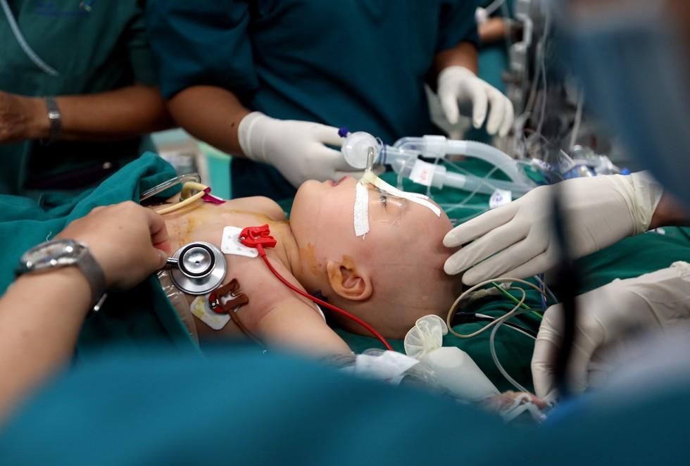 Những khoảnh khắc cân não và xúc động nhất ca đại phẫu tách cặp song sinh Trúc Nhi - Diệu Nhi-8