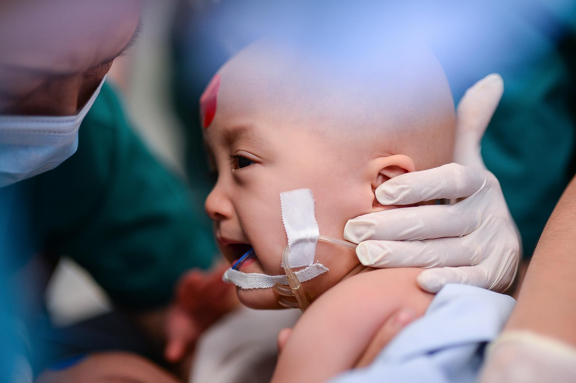 Hai bé Song Nhi đã tỉnh lại sau ca đại phẫu lịch sử kéo dài 13 tiếng-1