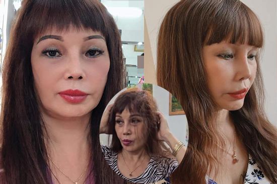 Chỉnh ảnh qua 7749 app, cô dâu Cao Bằng mặt vẫn lệch vẹo sau 3 tuần dao kéo