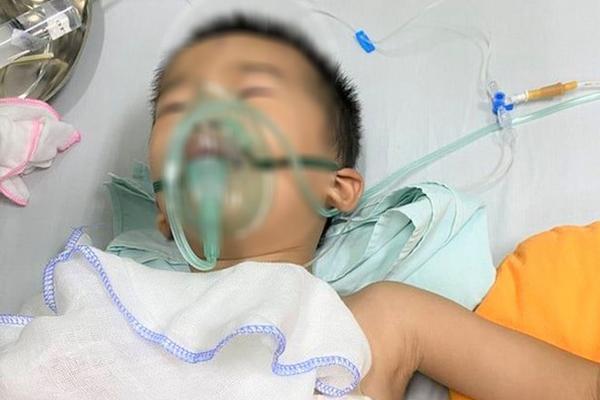 Bé 4 tuổi sờ đầu nghé, bị trâu mẹ húc thủng phổi-1