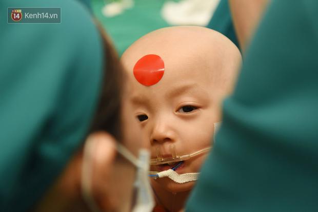 Cặp song sinh Trúc Nhi - Diệu Nhi vẫn còn đau sau ca mổ, người mẹ mua đồ chơi nhờ bác sĩ tiệt trùng gửi cho con-1