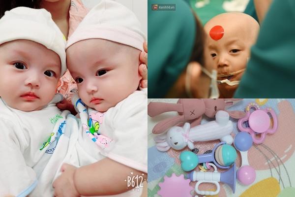 Cặp song sinh dính liền nổi tiếng Cúc - An thay đổi bất ngờ sau 17 năm phẫu thuật tách rời-4