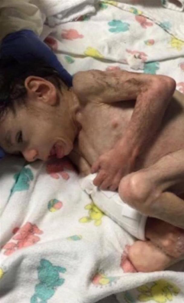 Cuộc sống của bé trai 8 tuổi chỉ nặng 7kg, gần như sắp chết được nhận nuôi-1