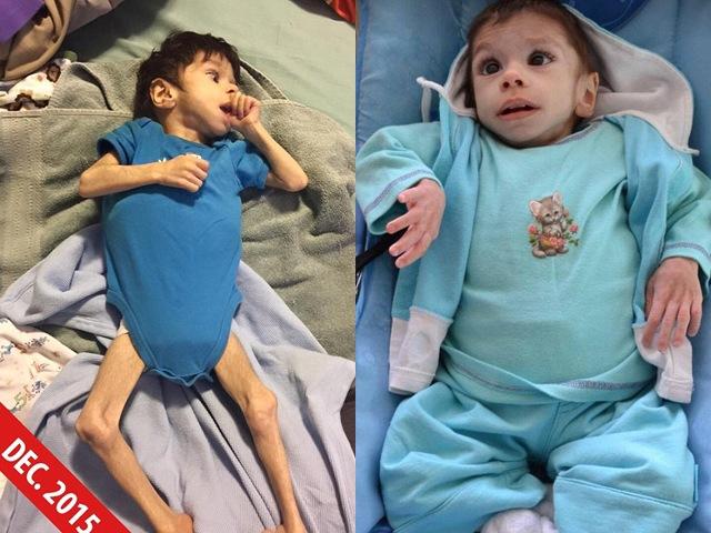 Cuộc sống của bé trai 8 tuổi chỉ nặng 7kg, gần như sắp chết được nhận nuôi-2