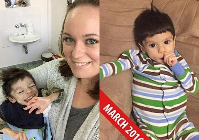 Cuộc sống của bé trai 8 tuổi chỉ nặng 7kg, gần như sắp chết được nhận nuôi-3