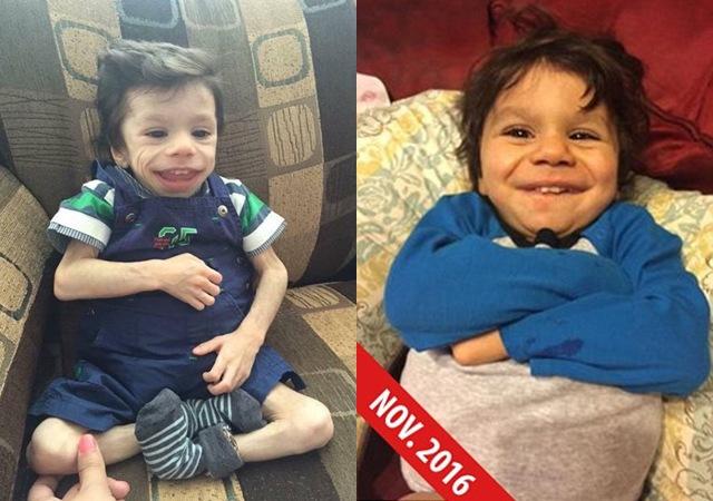 Cuộc sống của bé trai 8 tuổi chỉ nặng 7kg, gần như sắp chết được nhận nuôi-4