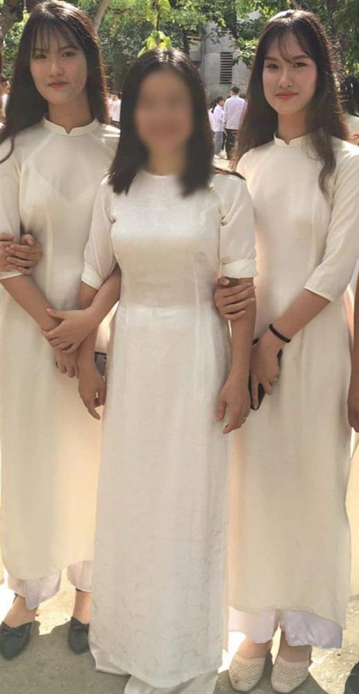 Cặp song sinh dính liền nổi tiếng Cúc - An thay đổi bất ngờ sau 17 năm phẫu thuật tách rời-2