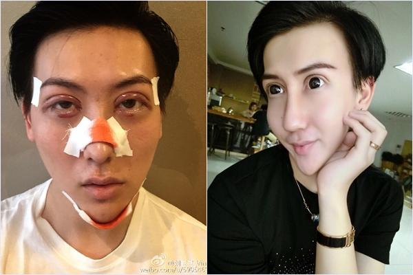 Chàng trai mặt rắn lộ thân hình như que củi sau thời gian vắng bóng-2